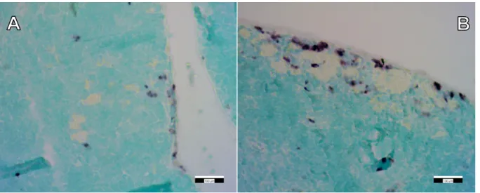 Figure 7. Immunohistochemical staining (CD68) of control (A) and “high dose” FSGM-treated (B) thymus tissue
