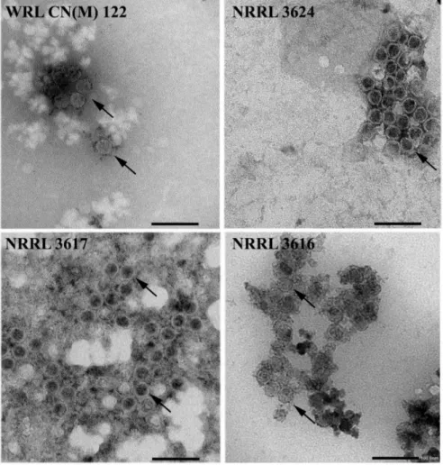 Figure 3. Morphology of virus particles detected in mycovirus-harboring Mucor strains