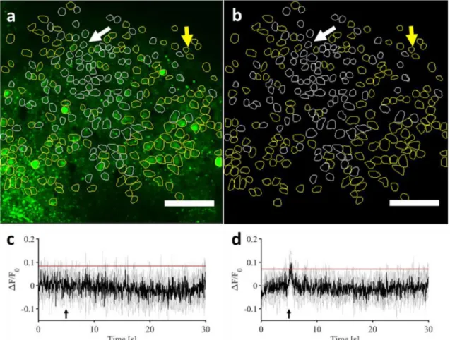 Figure 3 shows straight ahead that infrared pulses of 0.35 J  cm −2  induced calcium transients that could gener- gener-ate a fluorescence signal above noise in a very small population of cells