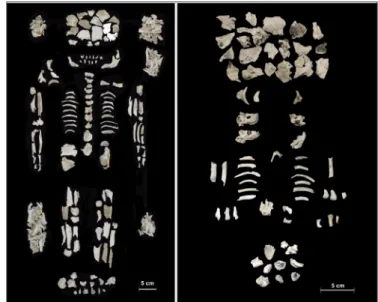 Fig. 5. Cremated bones of an adult female and her twin  foetuses of 7-8 months from Szigetszentmiklós–Ürgehegy 