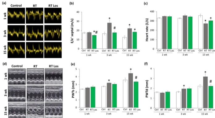 Figure 2. The effects of losartan on the echocardiographic parameters at weeks 1, 3, and 15