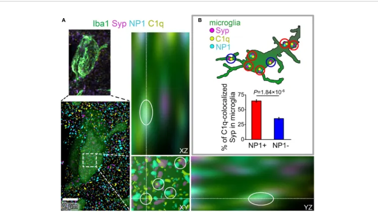 FIGURE 6 | The presence of NP1 in microglial engulfed C1q-tagged synapses. (A) Microglia were reconstructed from confocal image stacks using Iba1-staining (green) and engulfed, C1q- and Syp-colocalized NP1 spots (yellow, magenta, and cyan, respectively) we
