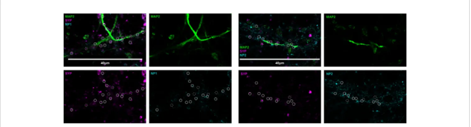 FIGURE 2 | Representative image of neuronal pentraxins along the axons. Mouse primary cortical neurons were immunostained for MAP2, Syp, and either NP1 or NP2