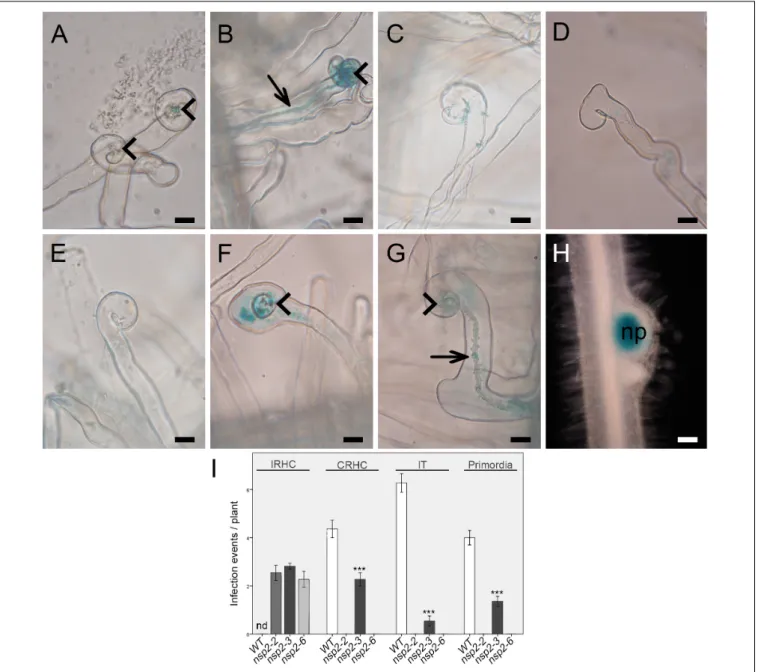 FIGURE 3 | Early infection phenotype of different nsp2 alleles. (A) Root hair curling at 2 days post inoculation (dpi) and (B) initiation of infection thread (IT) development on wild-type roots at 3 dpi with S