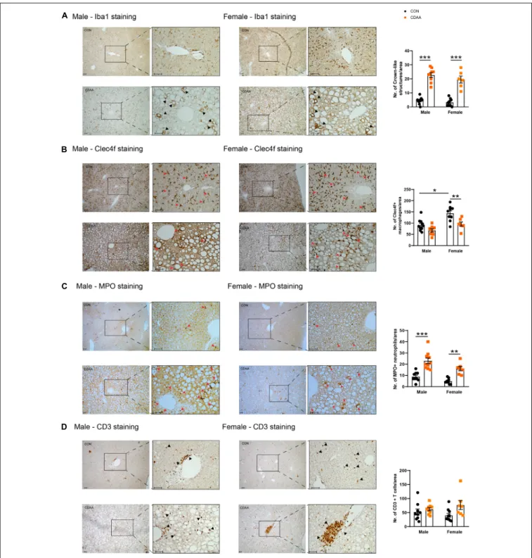 FIGURE 5 | Hepatic inflammatory cell infiltrates in CDAA-induced NASH. The extent of liver inflammation was evaluated by immunohistochemical assessment and quantification of the presence of macrophages/monocytes on hepatic sections by Iba1 staining (A) and