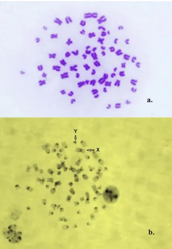 Fig. 1. 2N 5 66, XY karyotype, a: Giemsa staining; b: C-banding.