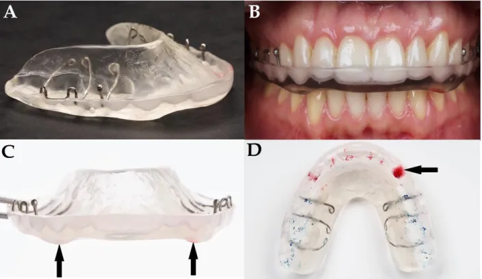 Figure 3B also shows an image from the incisal view of the preparation, thus it is not included in  the new figure