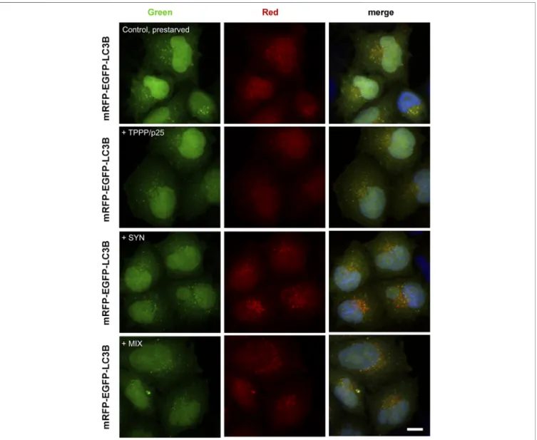 FIGURE 5 | Effects of SYN and/or TPPP/p25 on the autophagy maturation in LC3B-HeLa cells expressing tandem ﬂ uorescent-tagged LC3B (mRFP-EGFP) as detected by ﬂ uorescence confocal microscopy