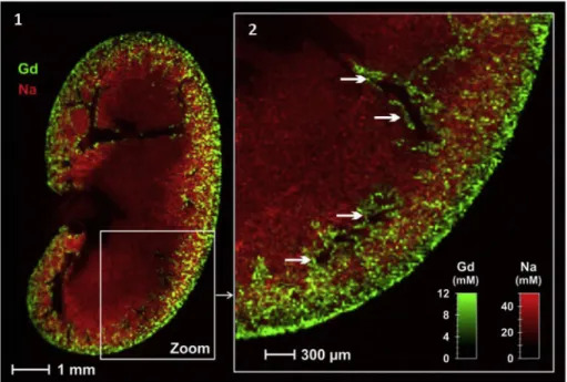 Fig. 6. Example of LIBS elemental images obtained for soft tissues. 1) Gadolinium (green) and sodium (red) distributions in a coronal murine kidney section, 24 h after gadolinium nanoparticle administration (spatial resolution of 40 m m)