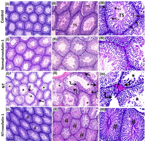 Fig. 2. Histopathological analysis of the testicular tissue: