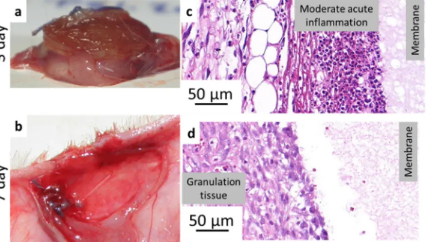 Fig 6. PASPCYS sample resected 3 days after implantation (a) and a representative image from histopathology (c);