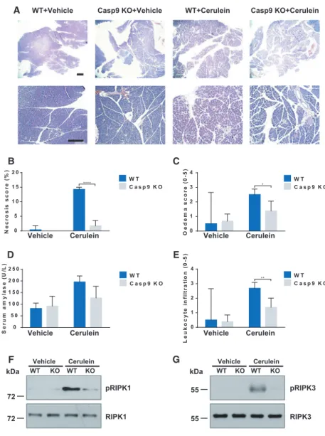 Fig. 7. Knockout of caspase-9 in pancreatic acinar cells decreases the severity of cerulein-induced AP