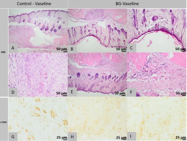 Figure 10. Histopathological images of the skin and subcutaneous tissue from the control animals of the group BG- BG-Vaseline: granulation tissue with few histiocytes (A), blood vessels and myofibrils (A), abundant granulation tissue,  partially oriented (
