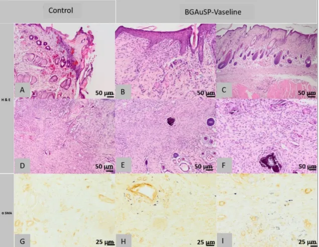 Figure 11. Histopathological images of the skin and subcutaneous tissue from the control animals from group BGAuSP- BGAuSP-Vaseline: partially healed surgical wound (A), discontinuous epidermis in the process of regeneration (A), scar tissue  contains few 