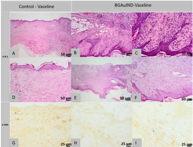 Figure 12. Histopathological images of the skin and subcutaneous tissue from the control animals from group BGAuIND- BGAuIND-Vaseline: completely healed surgical wound, absent pilosebaceous glands (A), excess granulation tissue with fusiform  cells, most m