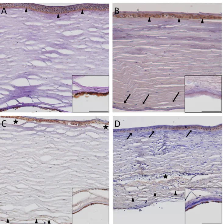 Figure 4. Matrilin-2 immunohistochemistry. Control cornea: Mild immunopositivity in the epithelium, most prominent in the basal layer  (arrowheads) and moderate in the endothelium (inset)