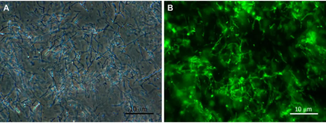 Fig. 2    Micrographs of hyphal  fragments. (A) Phase-contrast  micrograph of unstained (for  dry weight measurement) and  (B) fluorescence image of  WGA-AlexaFluor488-stained  (for fluorescence measurement)  hyphal fragments in sonicated  Periconia macros