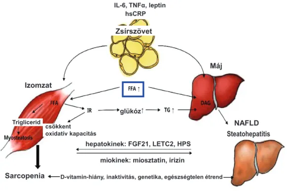 5. ábra A sarcopenia és a nem alkoholos zsírmáj kapcsolata [7]