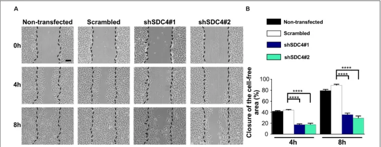 FIGURE 2 | Syndecan-4 influences the closure of the cell-free zone. (A) Representative microscopy images taken 0, 4, and 8 h after the initiation of a wound scratch assay