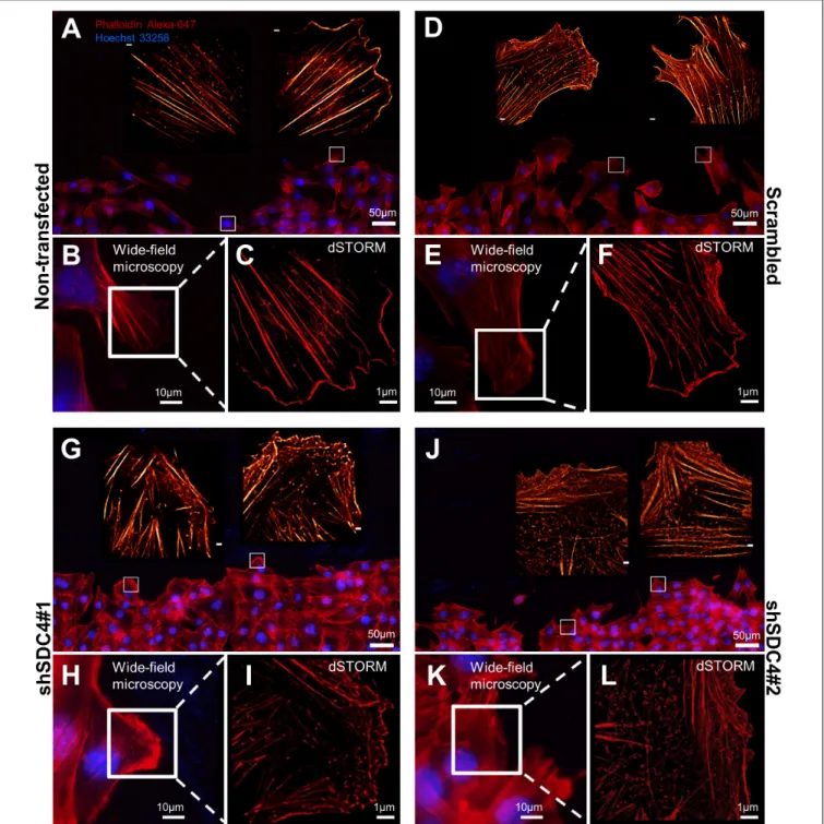 FIGURE 3 | Direct stochastic optical reconstruction microscopy (dSTORM) analysis of the actin cytoskeleton after syndecan-4 silencing