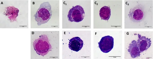 Figure 6. Microscopic analysis of the morphological changes on the THP-1. Representative images of  the monocytic THP-1 cells after 7 days of incubation with 100 μg/ml SiC–x NPs (A), SiC–NH 2  (B) and  SiC–OH (C 1 —dendritic  cell-like;  C 2 —monocytic;  a