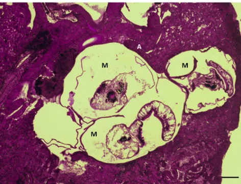 Figure 4. Histological section of the atrium of the heart of a pumpkinseed infected with metacercariae of Posthodiplostomum centrarchi