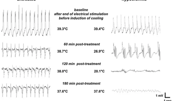 Fig. 2. Brain and core temperatures during cooling and rewarming [72].  