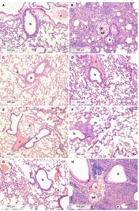 Figure 2. Histopathological alterations in the lung. Representative pictures of lung parenchyma after  (A) PBS and PO treatment, (B) LPS and PO treatment, (C) PBS and TO treatment, (D) LPS and TO  treatment, (E) PBS and CO treatment, (F) LPS and CO treatme