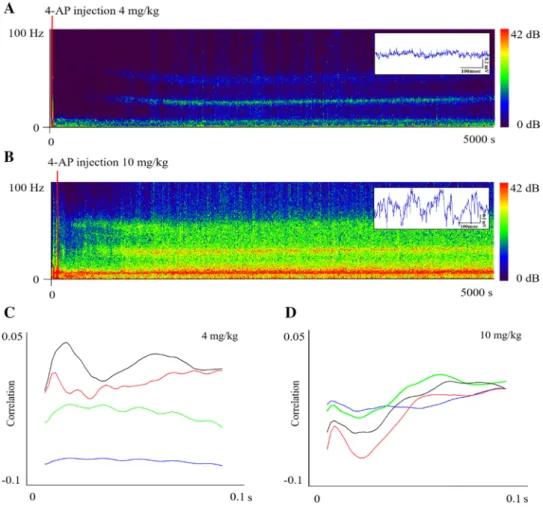 Fig. 1    Seizure EEG in two  doses represented in two  sonograms with raw data on the  satellite (a, b)