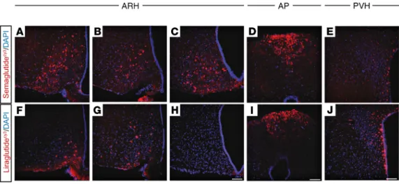 Figure 3. Differential distribution of semaglutide Cy3  and liraglutide Cy3  in the hypothalamus and AP