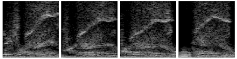 Fig.  1  shows  sample  images  taken  from  the  four  sessions  with  similar  tongue  positions