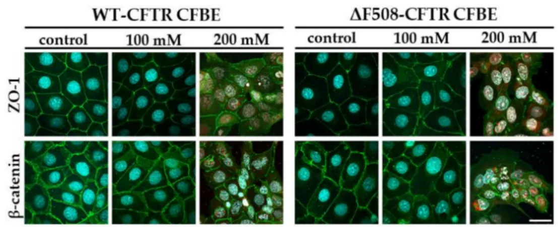 Figure 9. Morphology of CFBE cells after sodium bicarbonate treatment at different concentrations.