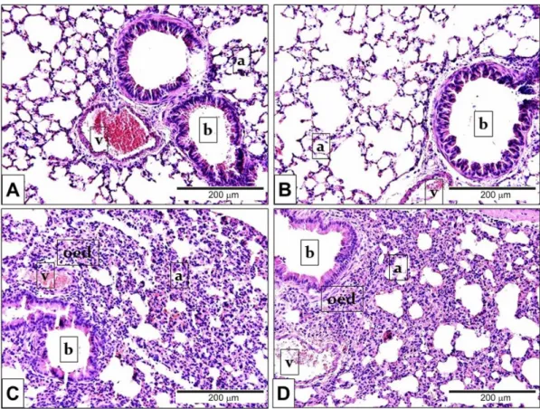 Figure 3. Representative histological pictures of LPS-induced pulmonary alterations. Compared to  the PBS-treated (A) Trpa1 +/+  and (B) Trpa1 −/−  control groups, the lung tissue of LPS-treated (C) Trpa1 +/+