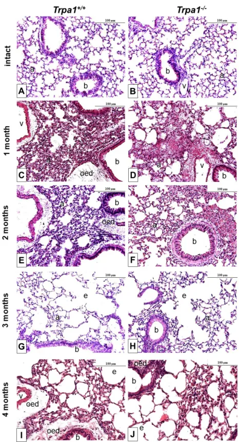 Figure 6. Representative histological pictures of the lungs of Trpa1 +/+  (A, C, E, G, I) and Trpa1 −/−  (B, D,  F,  H, J) mice under intact conditions (A,B), and after 1–4 months of CSE (C–J)