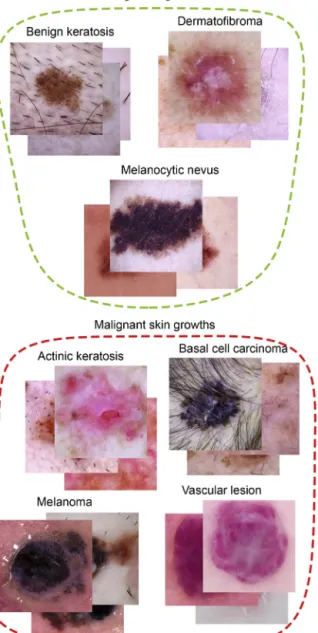 Fig. 2. Sample images for different types of skin lesions.