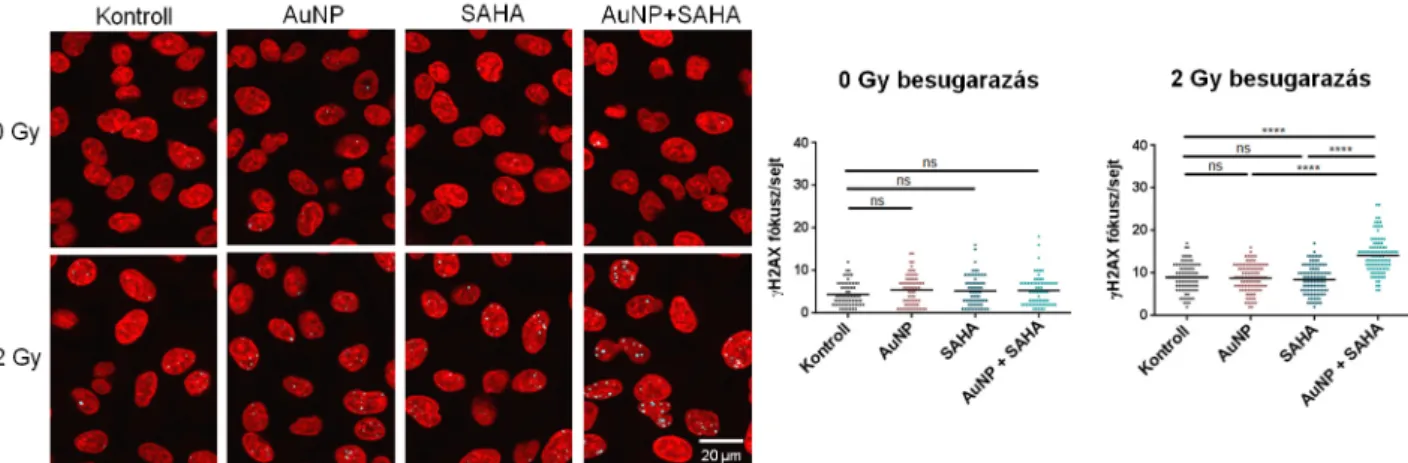 5. ábra. Az arany nanorészecskék (AuNP) és szuberoil-anilid-hidroxámsav (SAHA) alkalmazásának és az irradiációnak az együttes DNS károsító hatása A549 sejteken.