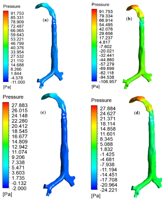Figure 8. Pressure variation in the mouth–throat and upper airways for various inlet conditions,   (a) heliox—60 l/min, (b) air—60 l/min, (c) heliox—30 l/min, and (d) air—30 l/min (same pressure scale  is used for comparison purpose)
