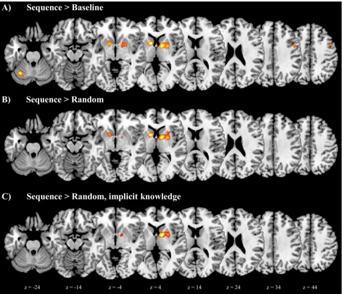 Figure 2. ALE analysis results for the neural correlates of sequence learning (horizontal  views)