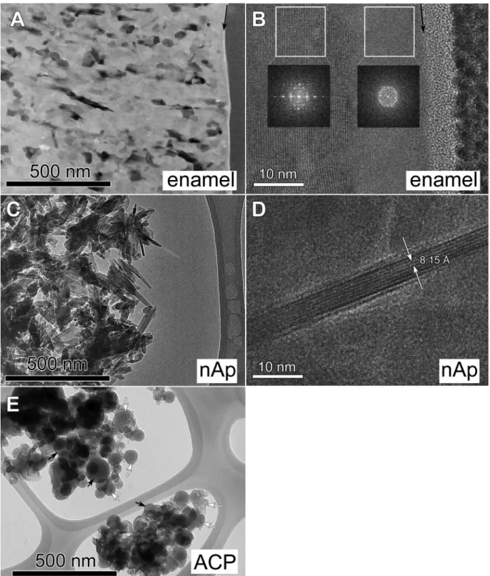 Fig. 7. TEM images of the studied samples after Mg exchange. (A) Bright ﬁeld image and (B) high resolution image of Mg treated primary dental enamel