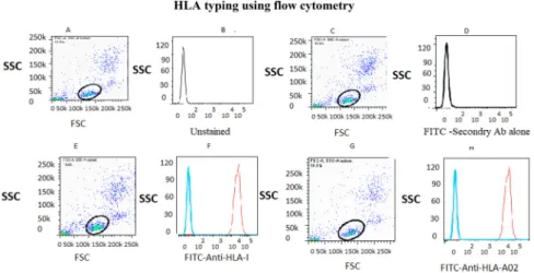 Fig. 1. HLA typing using ﬂow cytometry. Dot plot and histogram plot obtained from ﬂow cytometry analysis of PBMCs isolated from patients and healthy individuals