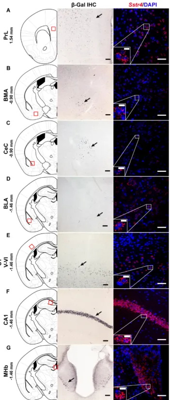 Figure 1. Representative β-galactosidase and Sstr4 mRNA expression in various mouse brain areas  (by β-Gal immunohistochemistry and singleplex fluorescent RNAscope)