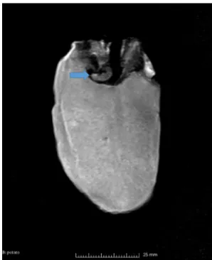 Fig. 3    MR scan of Phthorimaea operculella Zeller (Lep.: Gelechii-