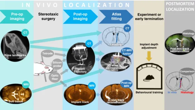 Fig. 1 In vivo localization work ﬂ ow. A few days before the surgery, preoperative CT and MRI scanning is performed, providing anatomical information about bone landmarks and brain structures, respectively