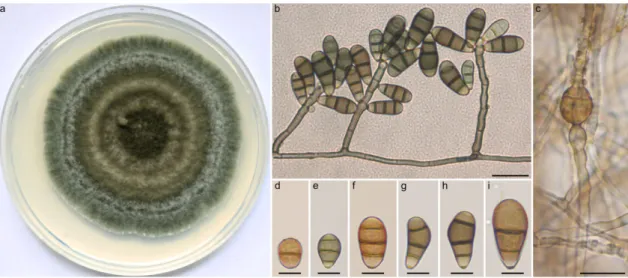 Figure 3. Morphological features of Curvularia tamilnaduensis SZMC 2226. (a) Colony morphology on  PDA medium after 7 d at 25 °C; (b) conidiophores with septate conidia; (c) subglobose intercalary  chlamydospore; (d–f) septate conidia