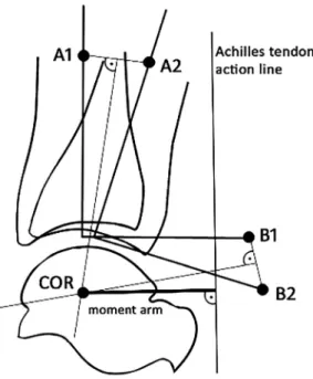 Fig. 2. Method used for locating the center of rotation (COR) at neutral joint position