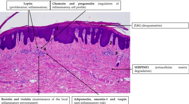 Figure 2. Adipokines might be involved in the pathogenesis of psoriasis vulgaris. Note the simplified  characteristic  histopathological  findings  in  psoriasis  skin:  hyperproliferation  of  keratinocytes  (1),  elongation  of  the  dermal  papillae  (2