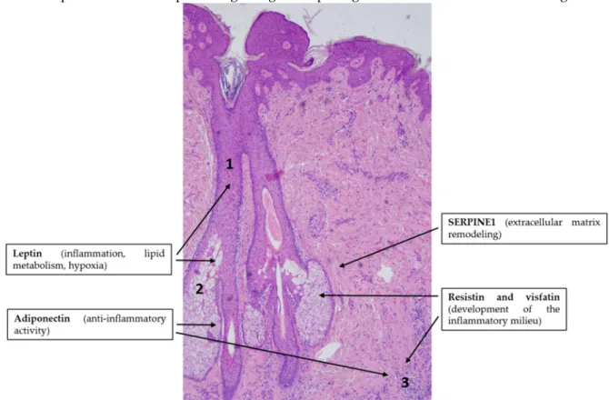 Figure  4. Adipokines  might  be  involved  in  the  pathogenesis  of  acne  vulgaris