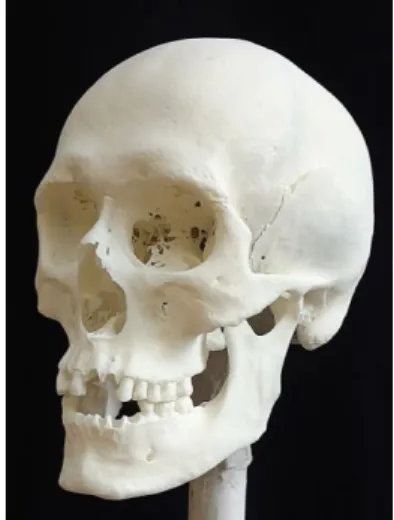 3. ábra: Honfoglaló férfi koponyája a Tuzsér- Tuzsér-Boszorkány-hegy 6. sírból, oldalnézet