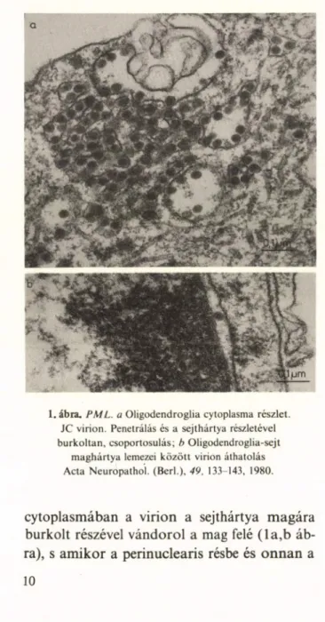 1. ábra.  PML.  a Oligodendroglia  Cytoplasma  részlet. 
