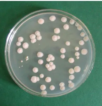 5. ábra: Oxytetracycline gentamicin glucose yeast extract (OGGY) agar